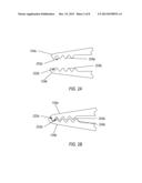 TISSUE EXTRACTION DEVICE diagram and image