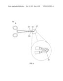 TISSUE EXTRACTION DEVICE diagram and image