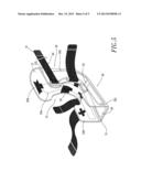 ANKLE PROTECTING DEVICE diagram and image