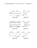 IMPLANTABLE FLUID MANAGEMENT SYSTEM FOR THE REMOVAL OF EXCESS FLUID diagram and image