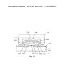 IMPLANTABLE FLUID MANAGEMENT SYSTEM FOR THE REMOVAL OF EXCESS FLUID diagram and image