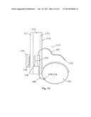 IMPLANTABLE FLUID MANAGEMENT SYSTEM FOR THE REMOVAL OF EXCESS FLUID diagram and image