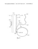 IMPLANTABLE FLUID MANAGEMENT SYSTEM FOR THE REMOVAL OF EXCESS FLUID diagram and image