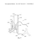 IMPLANTABLE FLUID MANAGEMENT SYSTEM FOR THE REMOVAL OF EXCESS FLUID diagram and image