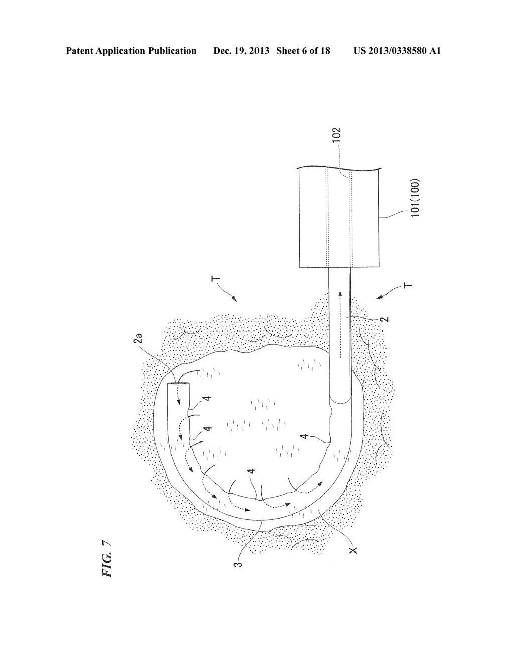 Endoscopic device - diagram, schematic, and image 07