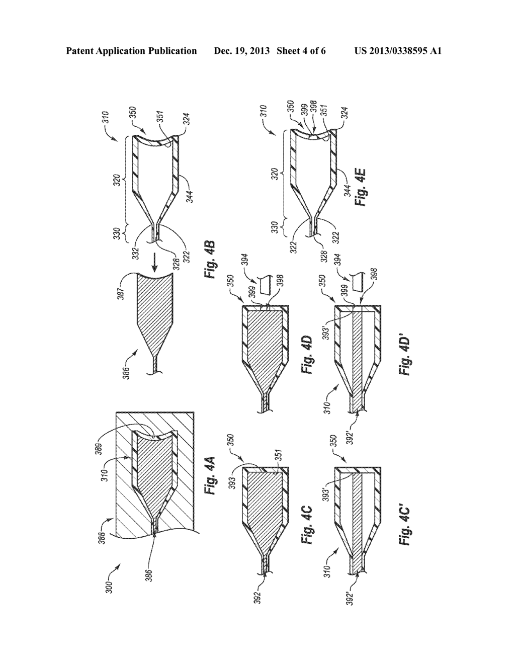 INTRODUCER SHEATH - diagram, schematic, and image 05