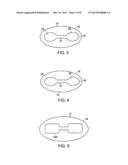 Valved Catheters Including High Flow Rate Catheters diagram and image