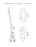 Valved Catheters Including High Flow Rate Catheters diagram and image