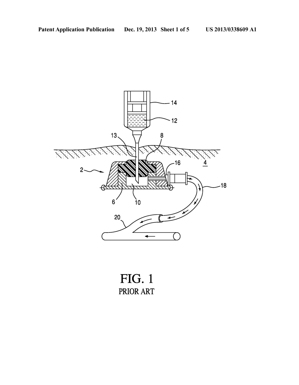 PORTAL WITH SEPTUM EMBEDDED INDICIA - diagram, schematic, and image 02