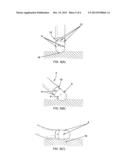 Ablation catheter electrode having multiple thermal sensors and method of     use diagram and image