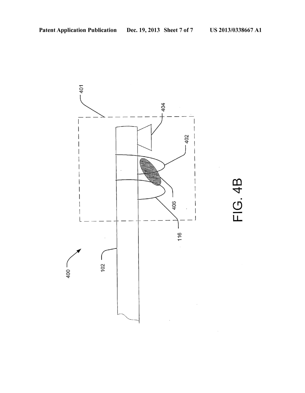 RESECTION LOOP FOR TISSUE RESECTION AND RELATED METHOD OF USE - diagram, schematic, and image 08