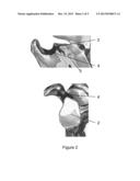 SHOULDER BASE PLATE COVERAGE AND STABILITY diagram and image