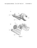 SHOULDER BASE PLATE COVERAGE AND STABILITY diagram and image