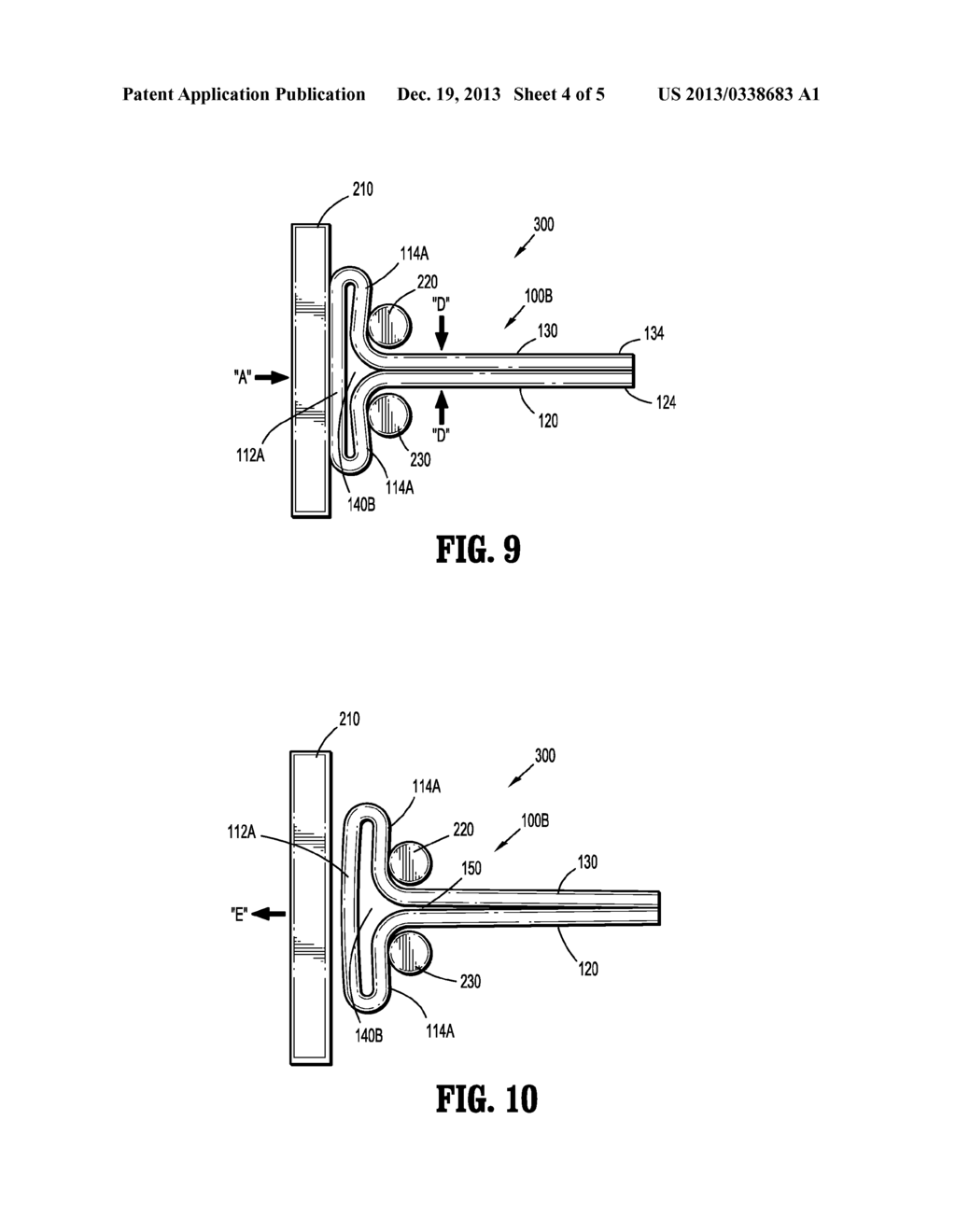 SYSTEM AND METHOD FOR FORMING A T-SHAPED SURGICAL CLIP - diagram, schematic, and image 05