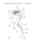 DEVICE AND METHOD FOR REMOVING UNWANTED MATERIAL IN A VASCULAR CONDUIT diagram and image