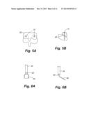 APPARATUS AND METHOD OF SPINAL IMPLANT AND FUSION diagram and image