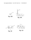 APPARATUS AND METHOD OF SPINAL IMPLANT AND FUSION diagram and image