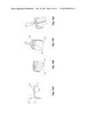 APPARATUS AND METHOD OF SPINAL IMPLANT AND FUSION diagram and image