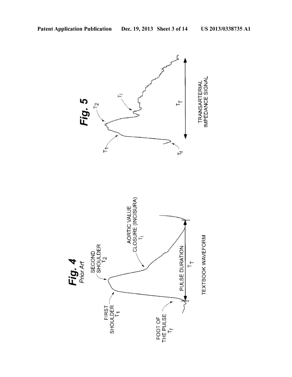 DEVICES AND METHODS FOR TREATMENT OF HEART FAILURE AND ASSOCIATED     CONDITIONS - diagram, schematic, and image 04