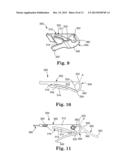 NERVE ELECTRODE diagram and image