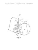 NERVE ELECTRODE diagram and image