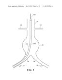 BIFURCATED ENDOVASCULAR PROSTHESIS HAVING TETHERED CONTRALATERAL LEG diagram and image