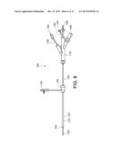 BIFURCATED ENDOVASCULAR PROSTHESIS HAVING TETHERED CONTRALATERAL LEG diagram and image