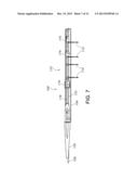 BIFURCATED ENDOVASCULAR PROSTHESIS HAVING TETHERED CONTRALATERAL LEG diagram and image