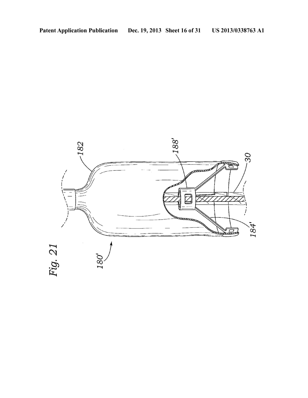 DEVICES AND METHODS FOR REDUCING CARDIAC VALVE REGURGITATION - diagram, schematic, and image 17