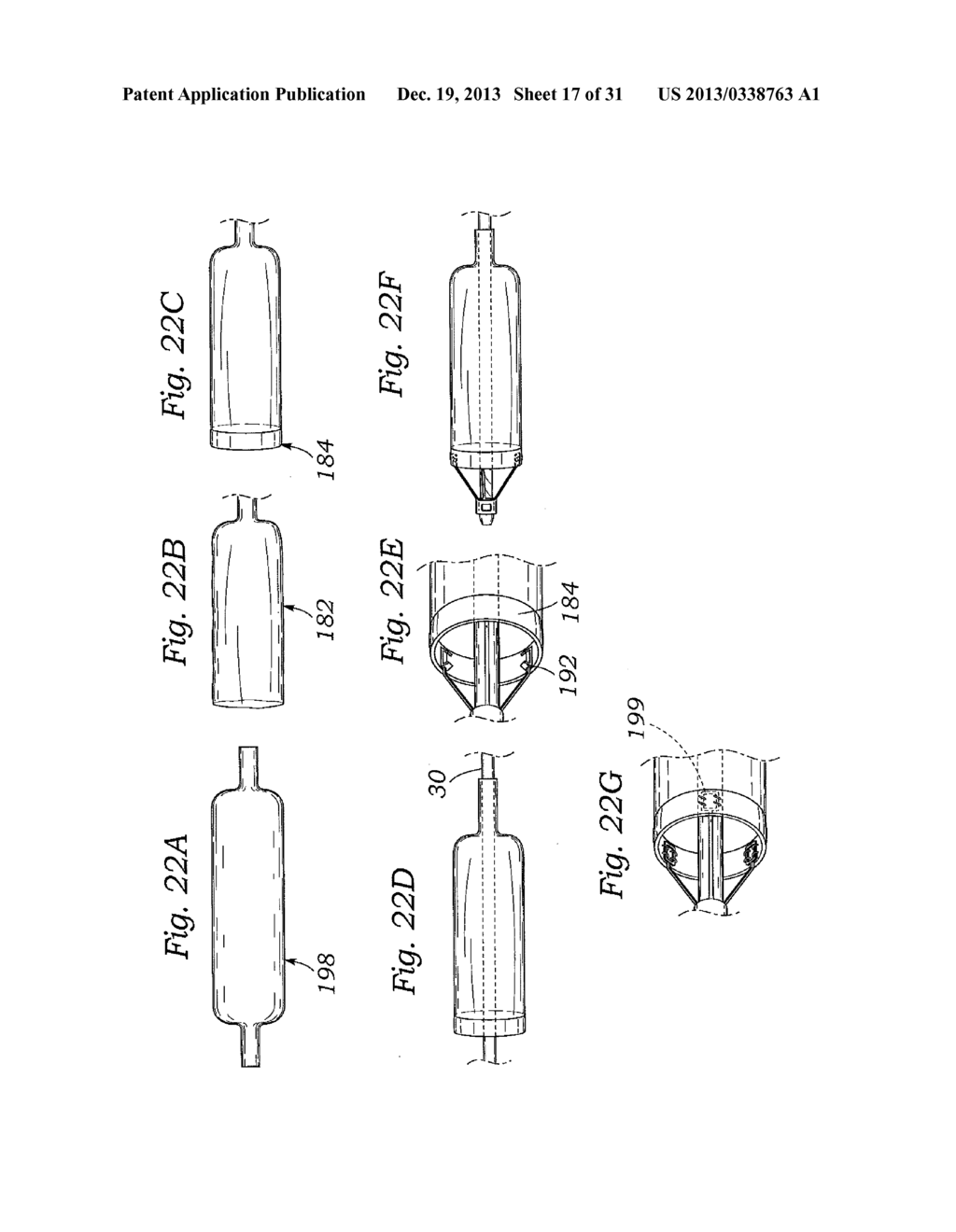 DEVICES AND METHODS FOR REDUCING CARDIAC VALVE REGURGITATION - diagram, schematic, and image 18