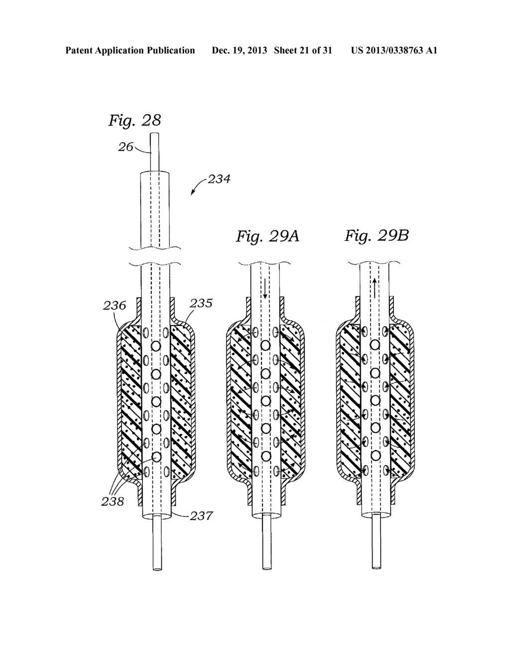 DEVICES AND METHODS FOR REDUCING CARDIAC VALVE REGURGITATION - diagram, schematic, and image 22