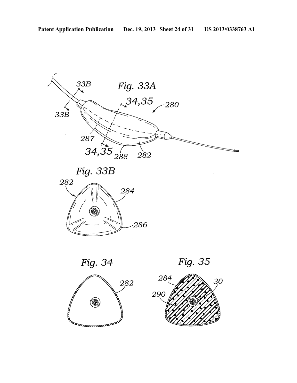 DEVICES AND METHODS FOR REDUCING CARDIAC VALVE REGURGITATION - diagram, schematic, and image 25