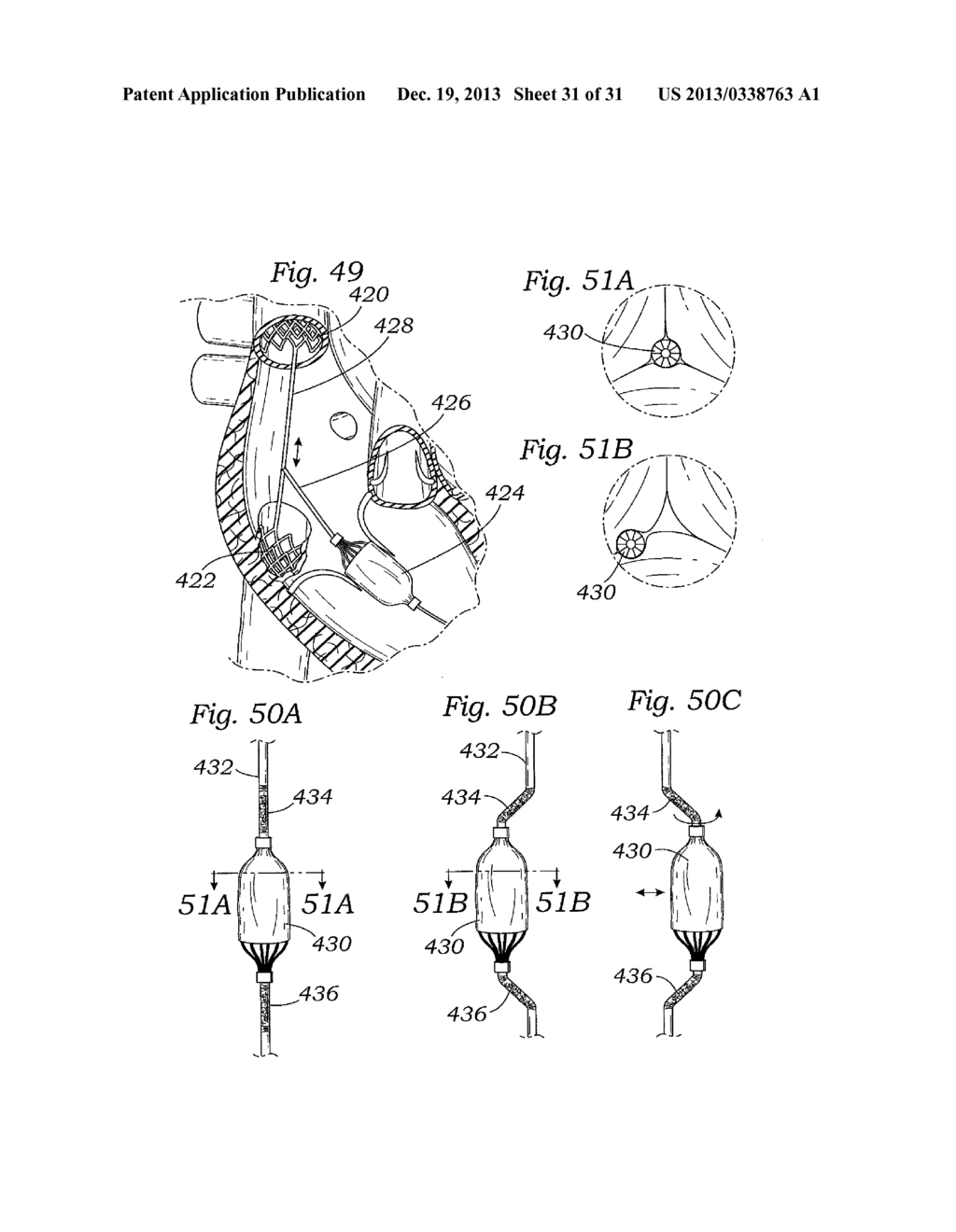 DEVICES AND METHODS FOR REDUCING CARDIAC VALVE REGURGITATION - diagram, schematic, and image 32