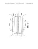 DEPLOYABLE INTERVERTEBRAL PROSTHESIS diagram and image