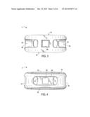 INTERBODY SPINAL IMPLANT HAVNG A ROUGHENED SURFACE TOPOGRAPHY diagram and image