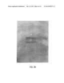 INTERBODY SPINAL IMPLANT HAVNG A ROUGHENED SURFACE TOPOGRAPHY diagram and image