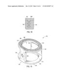 INTERBODY SPINAL IMPLANT HAVNG A ROUGHENED SURFACE TOPOGRAPHY diagram and image