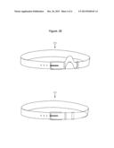 Excess Belt Loops diagram and image