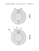 MOLDING SYSTEM HAVING A RESIDUE CLEANING FEATURE AND AN ADJUSTABLE MOLD     SHUT HEIGHT diagram and image