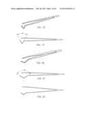 Tweezer Device Incorporating Improved Gripping Tip Structures, and Method     of using diagram and image