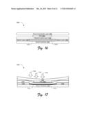 Interchangeable Surface Translation and Force Concentration diagram and image