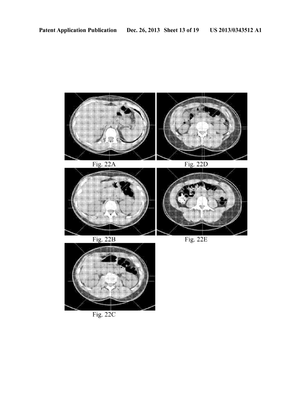 ADAPTIVE CONTROL OF SAMPLING FREQUENCY FOR COMPUTED TOMOGRAPHY - diagram, schematic, and image 14