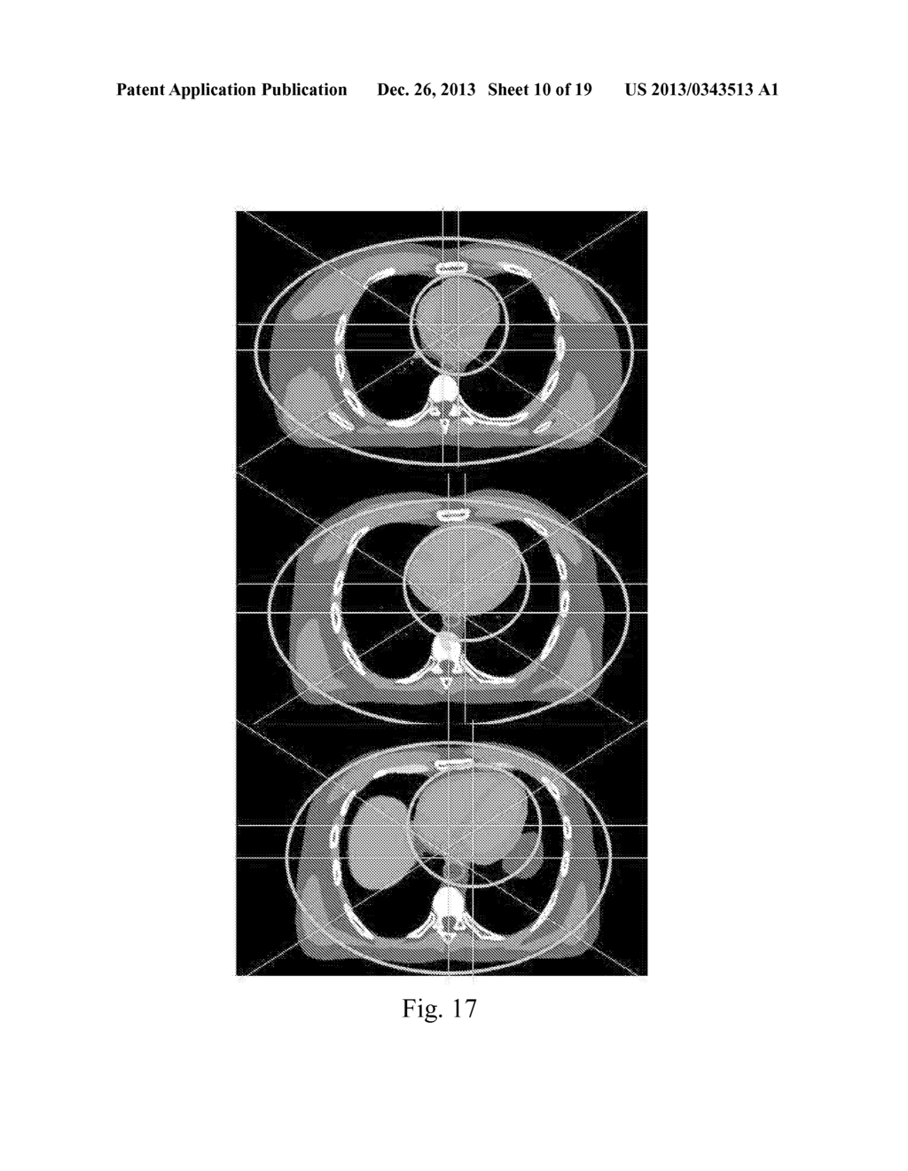 GRATED COLLIMATION SYSTEM FOR COMPUTED TOMOGRAPHY - diagram, schematic, and image 11