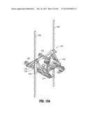 Skid mounted pipe arm with walkway and method diagram and image