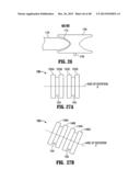 Skid mounted pipe arm with walkway and method diagram and image