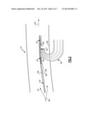 GAS TURBINE ENGINE WITH REVERSE-FLOW CORE HAVING A BYPASS FLOW SPLITTER diagram and image