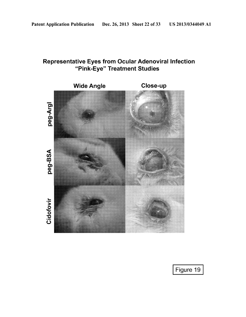 METHODS FOR TREATMENT OF OCULAR DISEASES - diagram, schematic, and image 23