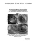 METHODS FOR TREATMENT OF OCULAR DISEASES diagram and image