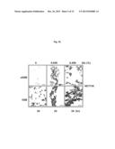 MODULATION OF HISTONE H2B MONOUBIQUITINATION AND TREATMENT OF CANCER diagram and image