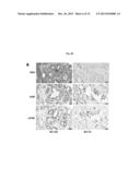 MODULATION OF HISTONE H2B MONOUBIQUITINATION AND TREATMENT OF CANCER diagram and image